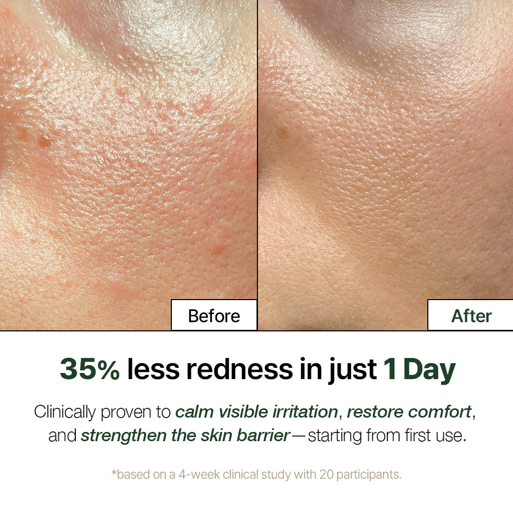 Cica Bio-Placenta Cream 20 NDP Cica Bio Placenta Cream Before After Soothing Sensitive Skin